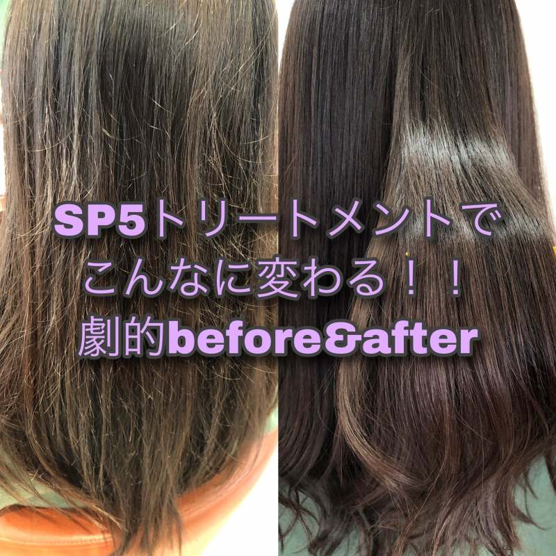 大人気のSP5トリートメントで劇的before&after！！