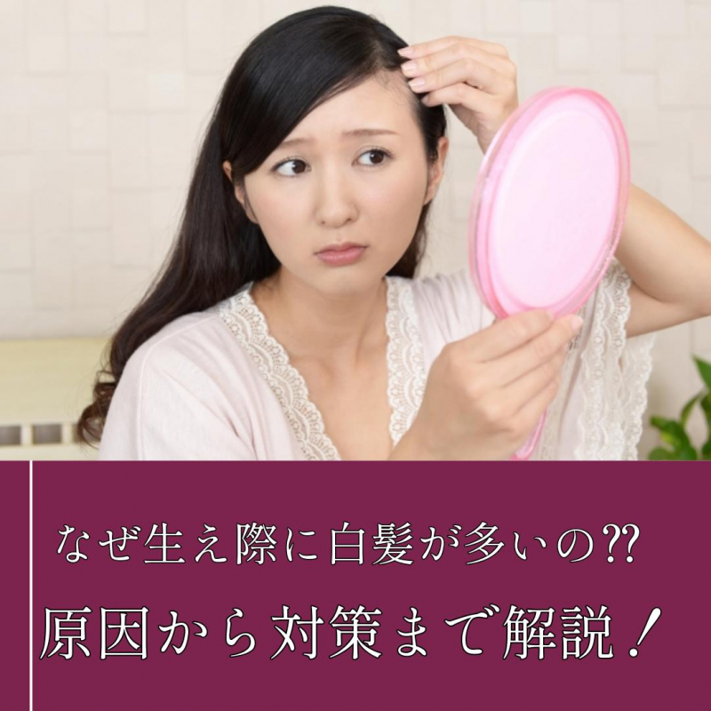 なぜ生え際に白髪が多いの⁇原因から対策まで解説します！