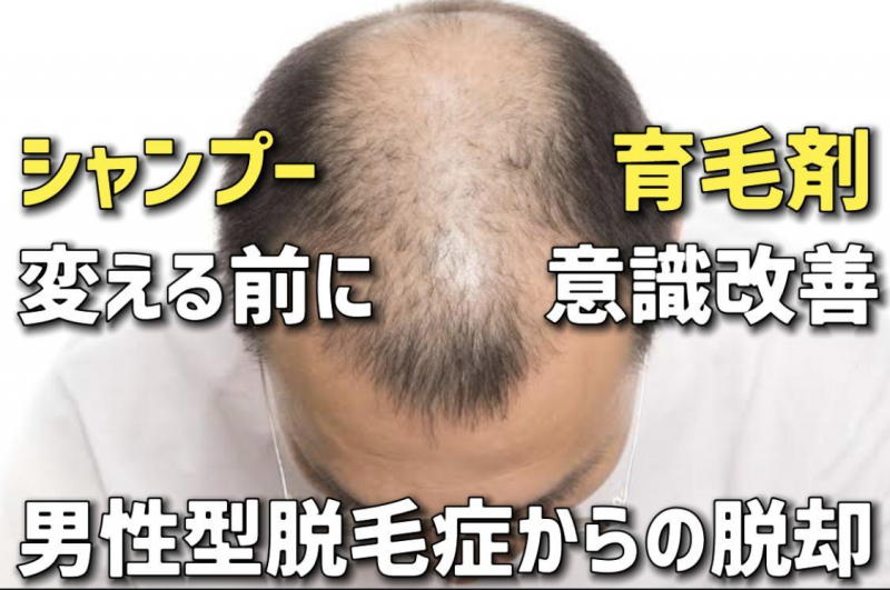 【男性薄毛】美容師が教える！ヘアスタイルで薄毛改善！