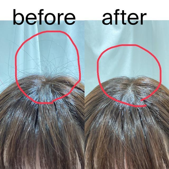 女子が気になるにっくきアホ毛…原因と簡単スタイリング方法！